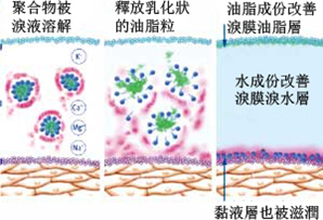 希瑪林順潮眼科中心_眼表疾病_乾眼症_人工淚液